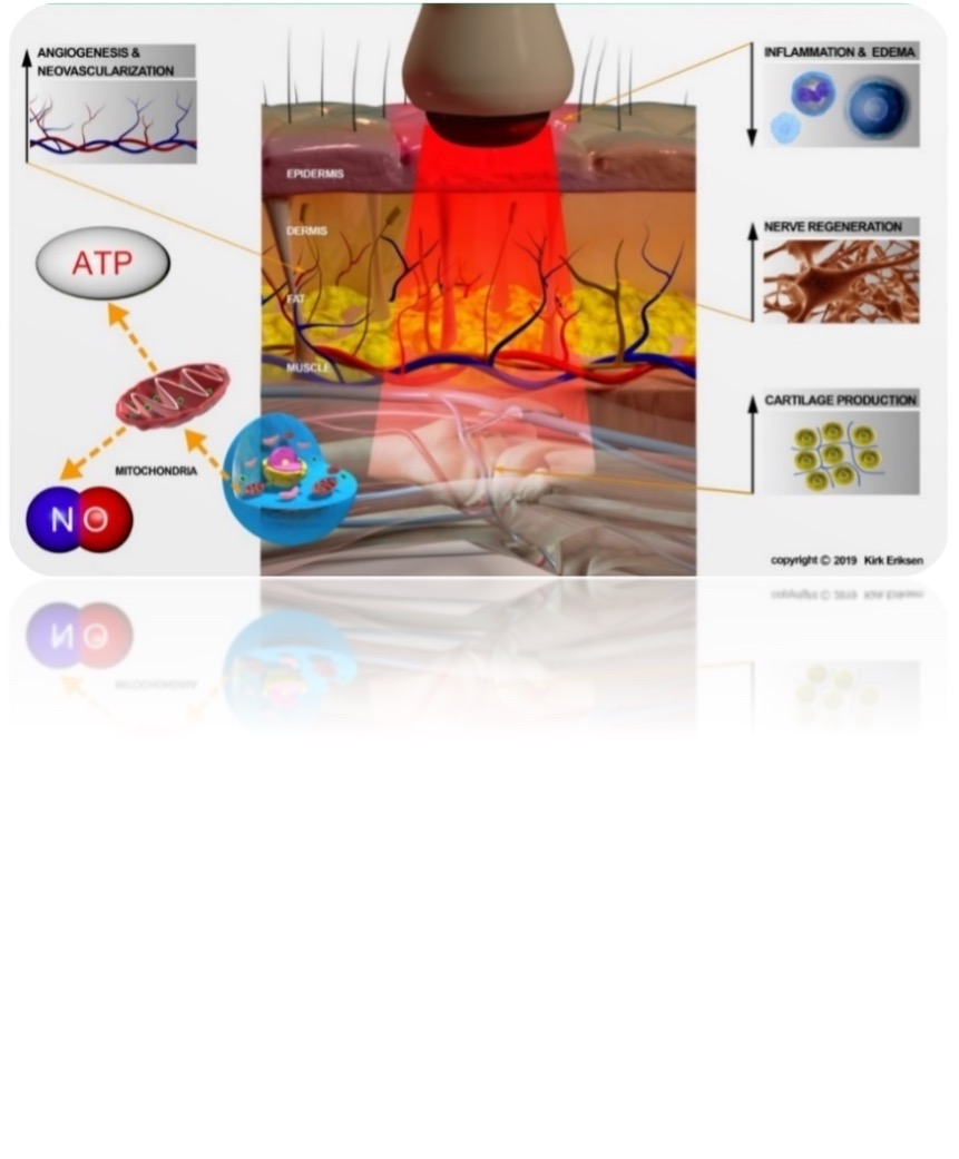Photobiomodulation therapy research and laser treatment equipment